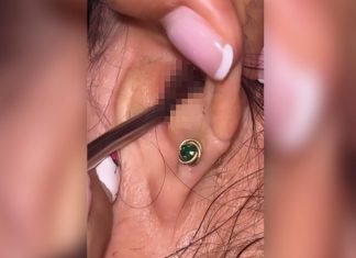 SVRBELO JE UVO DO BESVESTI, OTIŠLA U BOLNICU, A TAMO ŠOK: Kada su videli šta je unutra nisu mogli da veruju svojim očima! (FOTO)