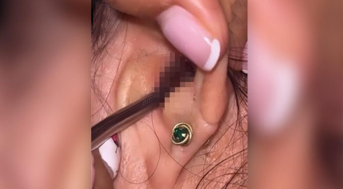 SVRBELO JE UVO DO BESVESTI, OTIŠLA U BOLNICU, A TAMO ŠOK: Kada su videli šta je unutra nisu mogli da veruju svojim očima! (FOTO)