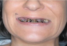 POZNATA PEVAČICA NE ZNA ŠTA ĆE SA PARAMA A ROĐENA SESTRA JOJ HODA KREZAVA: “Nemam novaca da napravim zube, jedva preživljavam”