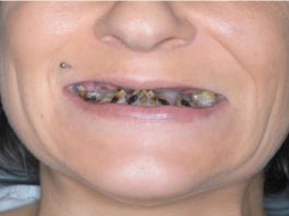 POZNATA PEVAČICA NE ZNA ŠTA ĆE SA PARAMA A ROĐENA SESTRA JOJ HODA KREZAVA: “Nemam novaca da napravim zube, jedva preživljavam”