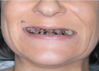 POZNATA PEVAČICA NE ZNA ŠTA ĆE SA PARAMA A ROĐENA SESTRA JOJ HODA KREZAVA: “Nemam novaca da napravim zube, jedva preživljavam”