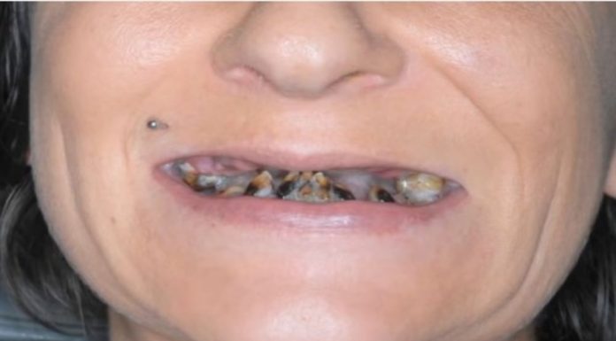 POZNATA PEVAČICA NE ZNA ŠTA ĆE SA PARAMA A ROĐENA SESTRA JOJ HODA KREZAVA: “Nemam novaca da napravim zube, jedva preživljavam”