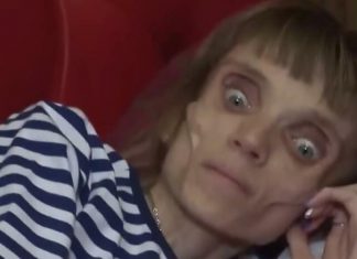 KRISTINA JE SPALA NA 17 KILOGRAMA, ljudi se prepadnu kada je vide: Hrana je postala njen neprijatelj, ranije je bila lepa kao san, evo kako je izgledala