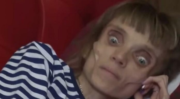 KRISTINA JE SPALA NA 17 KILOGRAMA, ljudi se prepadnu kada je vide: Hrana je postala njen neprijatelj, ranije je bila lepa kao san, evo kako je izgledala