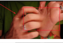 Ko god vam je rekao da ćete dobiti novac ako vas SVRBI LEVI DLAN, slagao vas je: Evo šta to stvarno znači – iznenadit ćete se