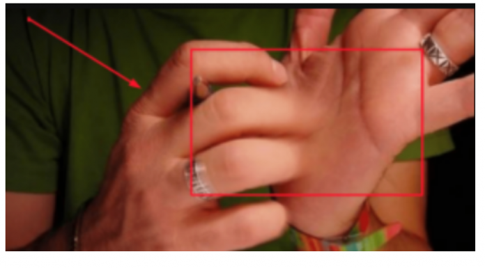 Ko god vam je rekao da ćete dobiti novac ako vas SVRBI LEVI DLAN, slagao vas je: Evo šta to stvarno znači – iznenadit ćete se