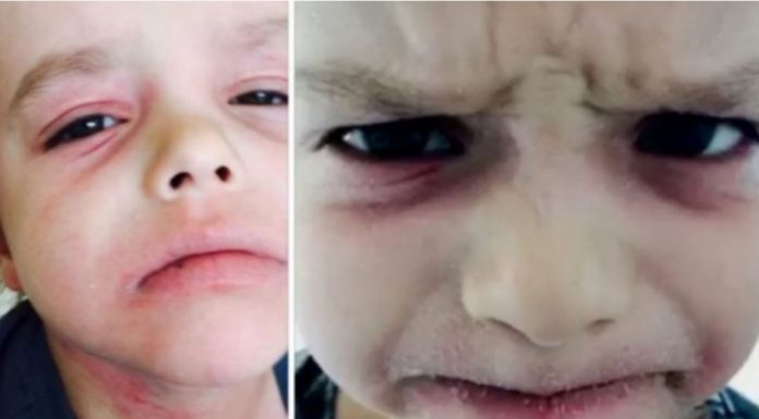 Majci niko nije verovao kada im je govorila šta se dešava sa njenim sinom – Doktori govorili da nije normalna, a onda je ona sve snimila i šokirala ih…