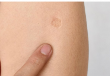 SVI KOJI SU  ROĐENI U JUGOSLAVIJI  IMAJU OVAJ OŽILJAK NA RUCI: Znate li kako je nastao i zbog čega? SVI SU IZNENAĐENI