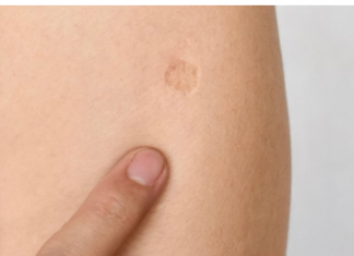 SVI KOJI SU ROĐENI U JUGOSLAVIJI IMAJU OVAJ OŽILJAK NA RUCI: Znate li kako je nastao i zbog čega? SVI SU IZNENAĐENI