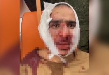 UZNEMIRUJUĆI SNIMAK: Terorista otkrio detalje nakon masakra u Moskvi, priznao šta je uradio sa ORUŽJEM (VIDEO)