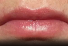 Simptomi bolesti srca koji se manifestiraju u ustima: Ako primetite nešto neobično, odmah nazovite hitnu pomoć!