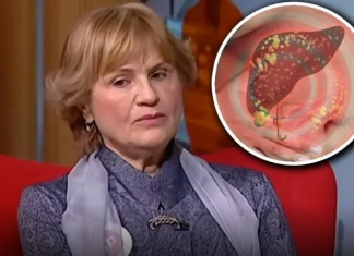 DOKTORKA RADMILA OTKILA KOJE SU NAJBOLJE NAMIRNICE ZA MASNU JETRU: Ono što je rekla o SURUTKI, mnoge će Š0KIRATI