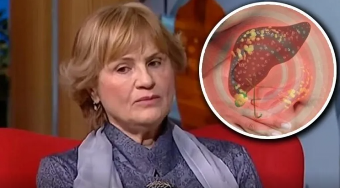 DOKTORKA RADMILA OTKILA KOJE SU NAJBOLJE NAMIRNICE ZA MASNU JETRU: Ono što je rekla o SURUTKI, mnoge će Š0KIRATI