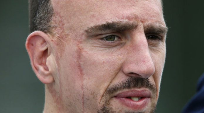 RODITELJI GA OSTAVILI NA PRAGU MANASTIRA PA POBEGLI, ZBOG RUŽNOĆE GA ZVALI KVAZIMODO: Obogatio se basnoslovno i svima ZAPUŠIO USTA