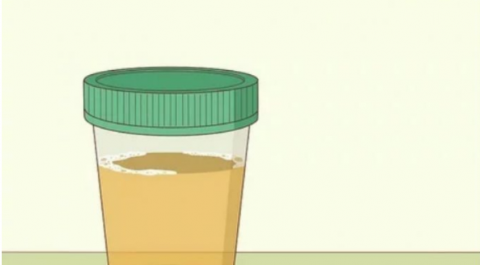 KOLIKO PUTA DNEVNO MOKRITE, EVO KOLIKO JE NORMALNO: Ako IZNAD OVE BROJKE, to je ozbiljan zdravstveni problem