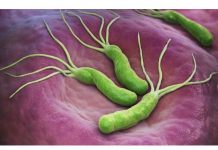 POVRĆKA KOJA UBIJA HELIKO BAKTERIJU, KISELINU I KARCINOM STOMAKA: Dovoljno je 70 grama dnevno!