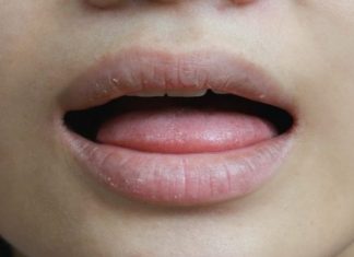 NE ZANEMARUJTE OVAJ SIMPTOM! Evo šta znače suha usta!