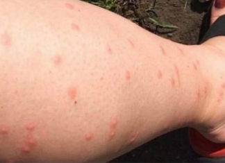 KOMARCI VAM PRAVE PAKAO OD ŽIVOTA? Samo isijecite OVO VOĆE na pola i ostavite u sobi, VIŠE IH NIKADA NEĆETE VIDJETI BLIZU!