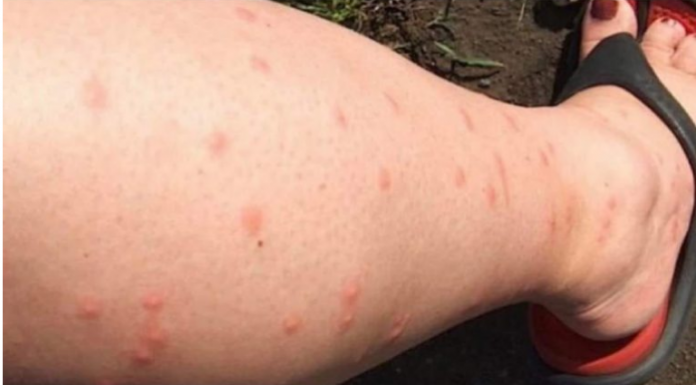 KOMARCI VAM PRAVE PAKAO OD ŽIVOTA? Samo isijecite OVO VOĆE na pola i ostavite u sobi, VIŠE IH NIKADA NEĆETE VIDJETI BLIZU!