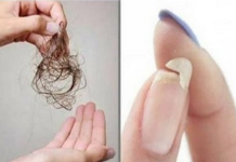 NE MOŽETE SPAVATI, IMATE LOMLJIVE NOKTE ILI VAM KOSA OPADA: Evo šta vam tijelo traži