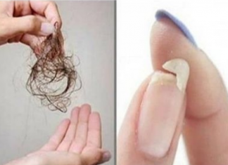 NE MOŽETE SPAVATI, IMATE LOMLJIVE NOKTE ILI VAM KOSA OPADA: Evo šta vam tijelo traži