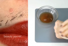 Prestani sa brijanjem! Ovo je najlakši i bezbolan način za uklanjanje dlačica na licu i tijelu!