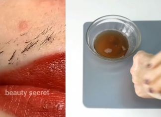 Prestani sa brijanjem! Ovo je najlakši i bezbolan način za uklanjanje dlačica na licu i tijelu!