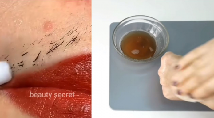 Prestani sa brijanjem! Ovo je najlakši i bezbolan način za uklanjanje dlačica na licu i tijelu!