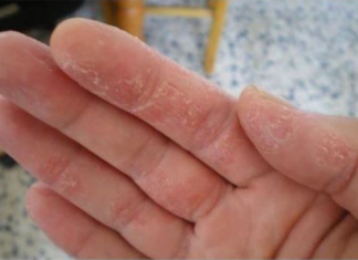 PUCANJE KOŽE, TRNCI ILI OPADANJE KOSE SU PRVI ZNAKOVI: Evo šta vam tijelo govori!