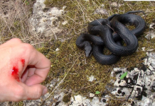 Šta prvo treba uraditi ako vas ujede zmija? Jednim potezom mnogi prave istu grešku, a može biti kobna
