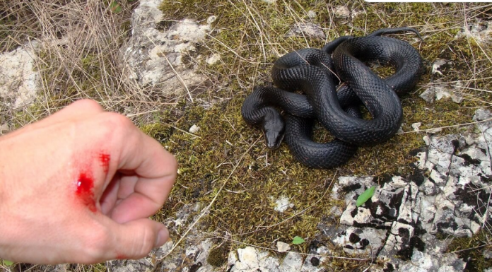 Šta prvo treba uraditi ako vas ujede zmija? Jednim potezom mnogi prave istu grešku, a može biti kobna