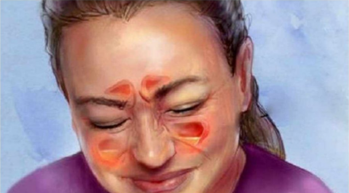 IZLIJEČITE SINUSNU INFEKCJU ZA SAMO 20 SEKUNDI: Napravite ovaj domaći napitak i gledajte ČUDO!