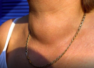 BOLEST SAVREMENOG DOBA SE VIDI NA VRATU: Promene se javljaj PRVO NA OBRVAMA – dobro se zagledajte u njih