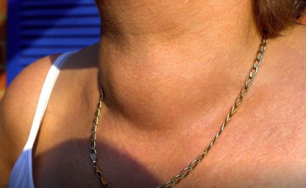 BOLEST SAVREMENOG DOBA SE VIDI NA VRATU: Promene se javljaj PRVO NA OBRVAMA – dobro se zagledajte u njih