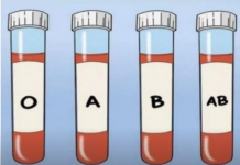OVA KRVNA GRUPA JE NAJRIZIČNIJA ZA SRCE: Naučnici otkrili kod koga se krv zgrušava, A KOJA KRVNA GRUPA IMA POVIŠEN PRITISAK