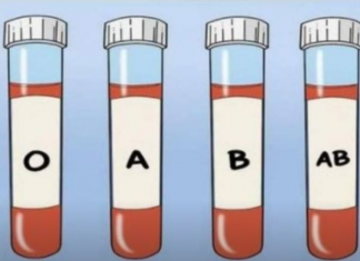 OVA KRVNA GRUPA JE NAJRIZIČNIJA ZA SRCE: Naučnici otkrili kod koga se krv zgrušava, A KOJA KRVNA GRUPA IMA POVIŠEN PRITISAK