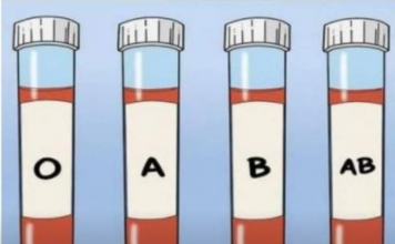 OVA KRVNA GRUPA JE NAJRIZIČNIJA ZA SRCE: Naučnici otkrili kod koga se krv zgrušava, A KOJA KRVNA GRUPA IMA POVIŠEN PRITISAK