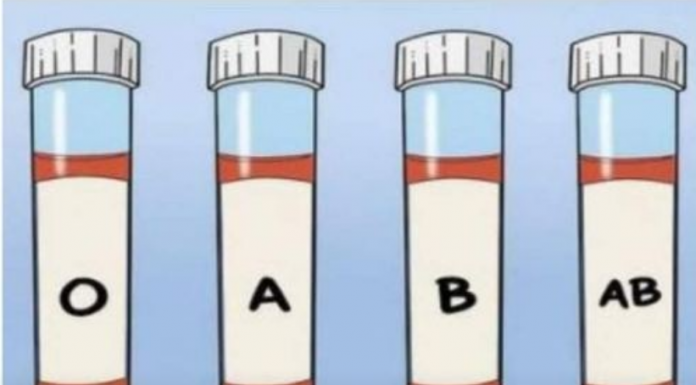 OVA KRVNA GRUPA JE NAJRIZIČNIJA ZA SRCE: Naučnici otkrili kod koga se krv zgrušava, A KOJA KRVNA GRUPA IMA POVIŠEN PRITISAK