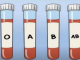 OVA KRVNA GRUPA JE NAJRIZIČNIJA ZA SRCE: Naučnici otkrili kod koga se krv zgrušava, A KOJA KRVNA GRUPA IMA POVIŠEN PRITISAK