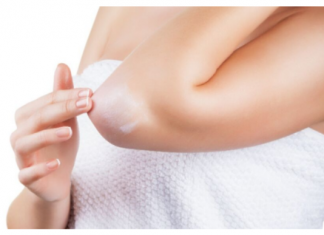 OVA PROMJENA NA LAKTU GOVORI DA SA VAŠIM ORGANIZMOM NEŠTO NIJE U REDU: Evo o kakvoj bolesti se radi