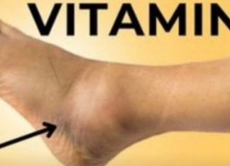 Ključni VITAMIN za uklanjanje OTEKLINA NOGU, NOŽNIH ZGLOBOVA I STOPALA!