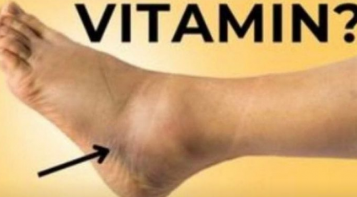 Ključni VITAMIN za uklanjanje OTEKLINA NOGU, NOŽNIH ZGLOBOVA I STOPALA!
