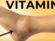 Ključni VITAMIN za uklanjanje OTEKLINA NOGU, NOŽNIH ZGLOBOVA I STOPALA!