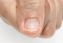 Nedostatak važnih vitamina i minerala u tijelu očituje se vrlo jasnim simptomima! Ali malo ljudi zna da ih muči ovaj problem, NAUČITE IH PREPOZNATI