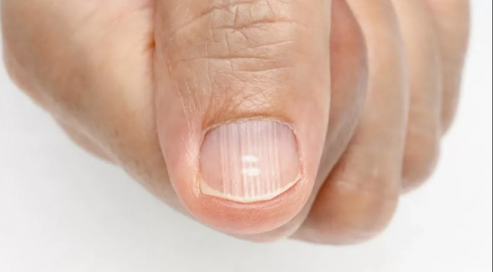 Nedostatak važnih vitamina i minerala u tijelu očituje se vrlo jasnim simptomima! Ali malo ljudi zna da ih muči ovaj problem, NAUČITE IH PREPOZNATI