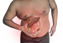 Budite oprezni zbog simptoma jer oni mogu ukazivati na oštećenje jetre: Ovo su nepogrešivi pokazatelji