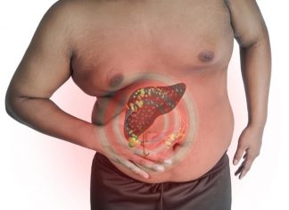 Budite oprezni zbog simptoma jer oni mogu ukazivati na oštećenje jetre: Ovo su nepogrešivi pokazatelji