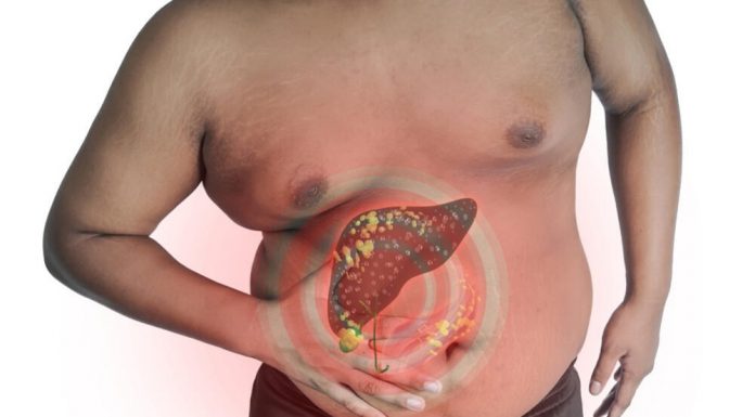 Budite oprezni zbog simptoma jer oni mogu ukazivati na oštećenje jetre: Ovo su nepogrešivi pokazatelji