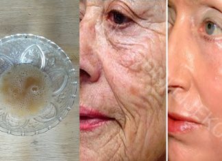 VJEROVALI ILI NE – SIRĆE VAM MOŽE POMOĆI DA SE RIJEŠITE BORA, AKNI I STARAČKIH PJEGA