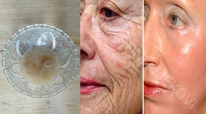 VJEROVALI ILI NE – SIRĆE VAM MOŽE POMOĆI DA SE RIJEŠITE BORA, AKNI I STARAČKIH PJEGA